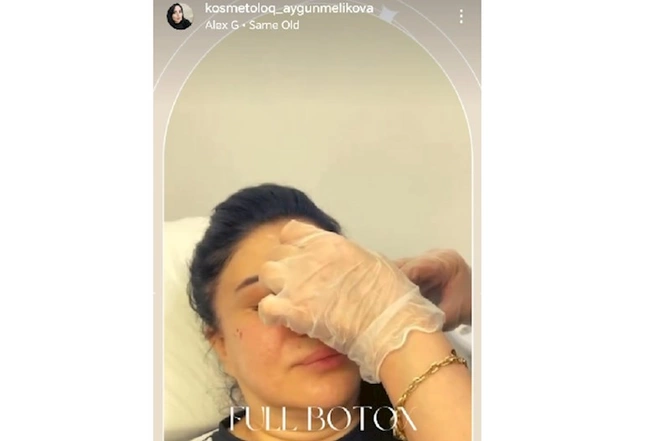 Lisenziyasız,sertifakatsız fəaliyyət göstərən kosmetoloq — Aygün Məlikova (FOTOLAR) Lisenziyasız,sertifakatsız fəaliyyət göstərən kosmetoloq — Aygün Məlikova (FOTOLAR)