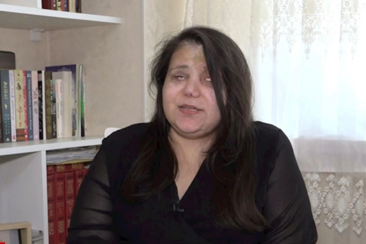Gəncə terrorunda gözlərini itirən qadın başına gələnləri danışdı: Qoymayın ölüm, qızlarım var (VİDEO)