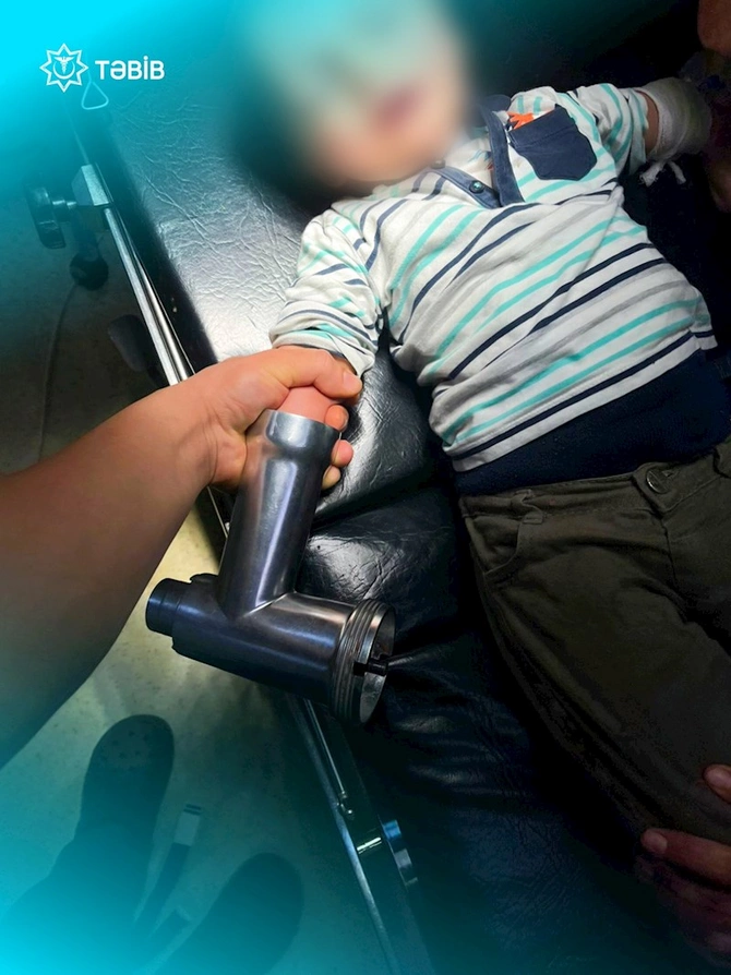 2 yaşlı körpənin əli ətçəkən maşında qaldı — FOTO