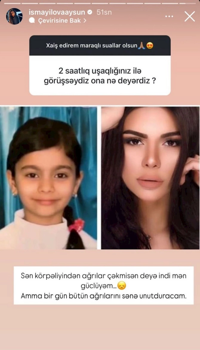 Vəkil ərindən ayrılan Aysun: “Xəyanət ucuz insanların işidir” — FOTOLAR