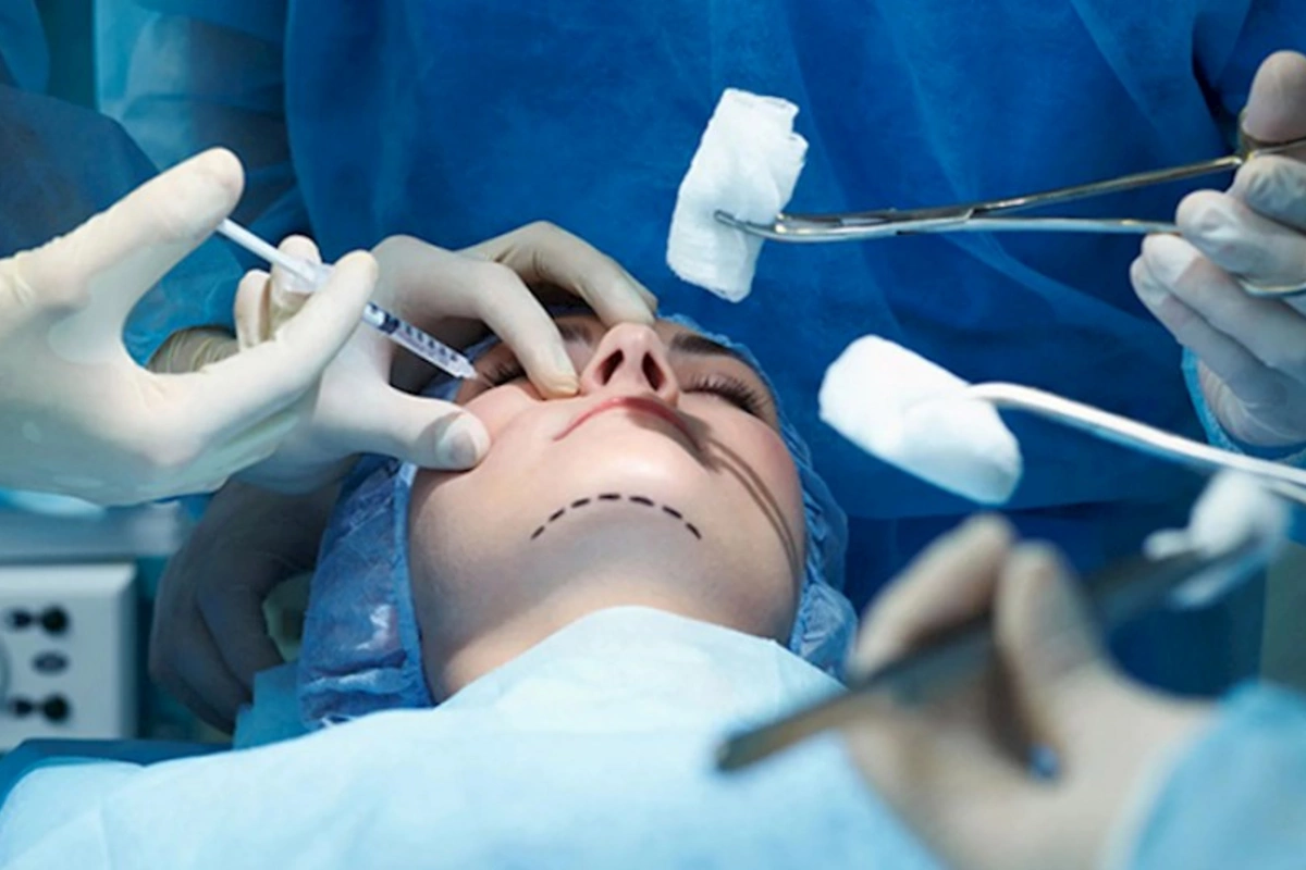 Plastik cərrahların lisenziyalarının ləğvi ilə bağlı RƏSMİ AÇIQLAMA