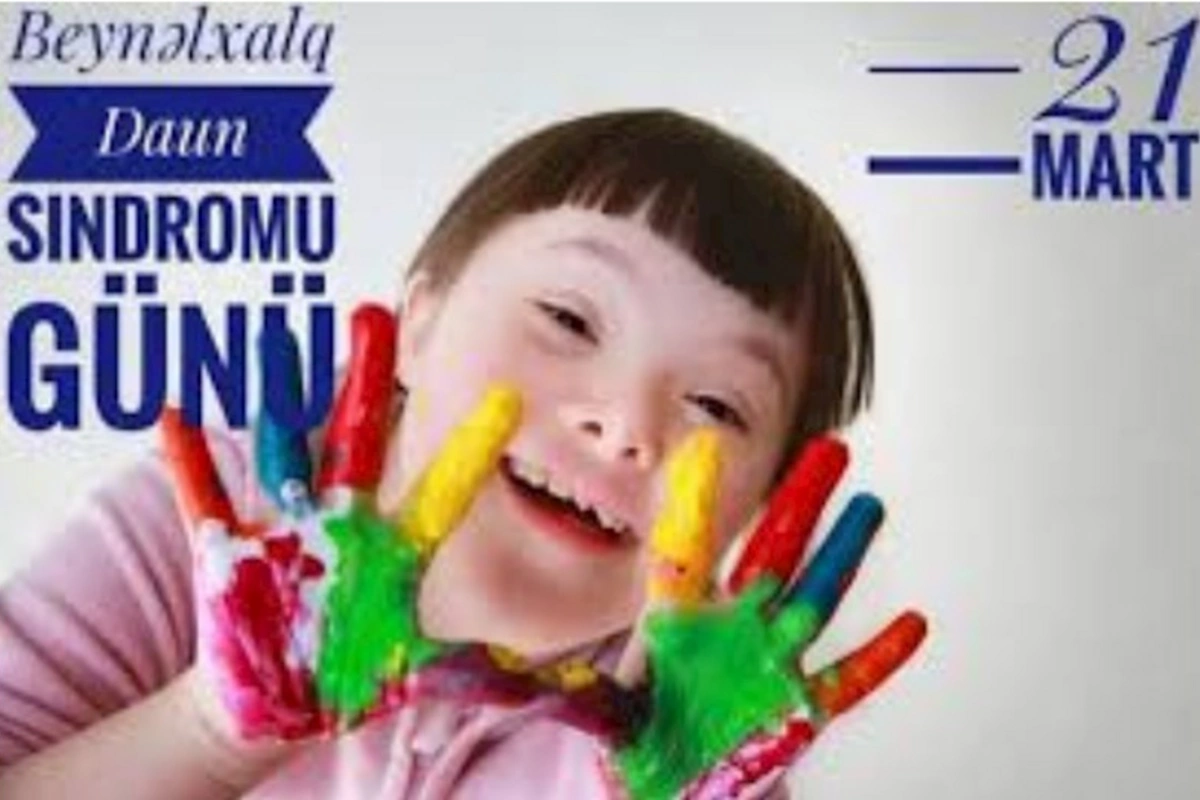 Bu gün Beynəlxalq Daun Sindromu Günüdür
