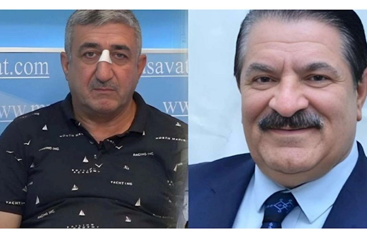 Ağadadaş Ağayevin balta atdığı mühafizəçi həbs edilib