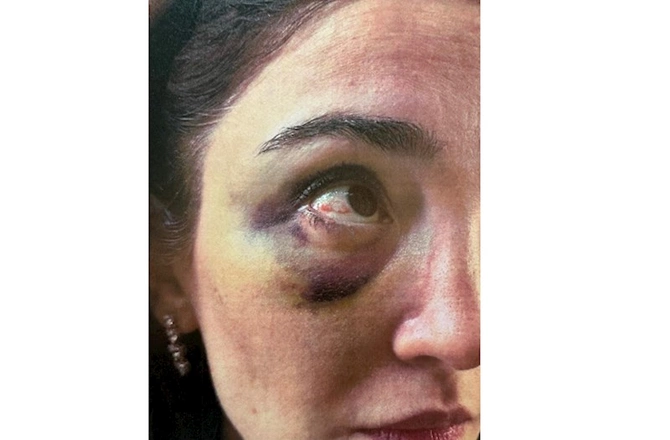 Məzahir Pənahovun oğlu arvadına işgəncə verib — Ağır ittihamlar (FOTOLAR)