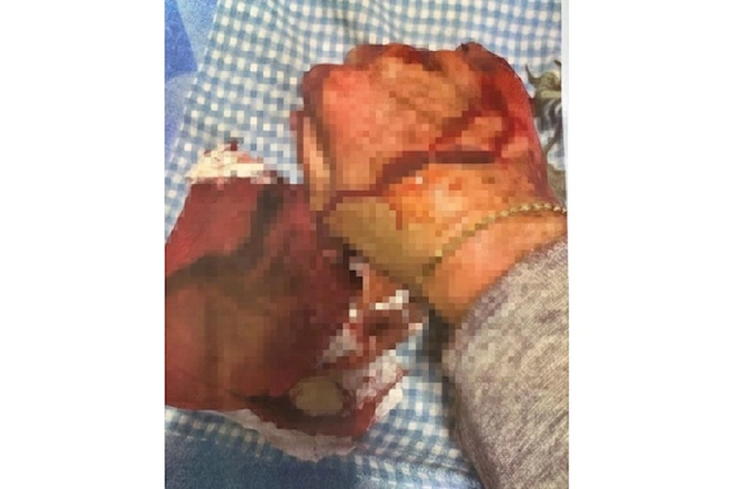 Məzahir Pənahovun oğlu arvadına işgəncə verib — Ağır ittihamlar (FOTOLAR)