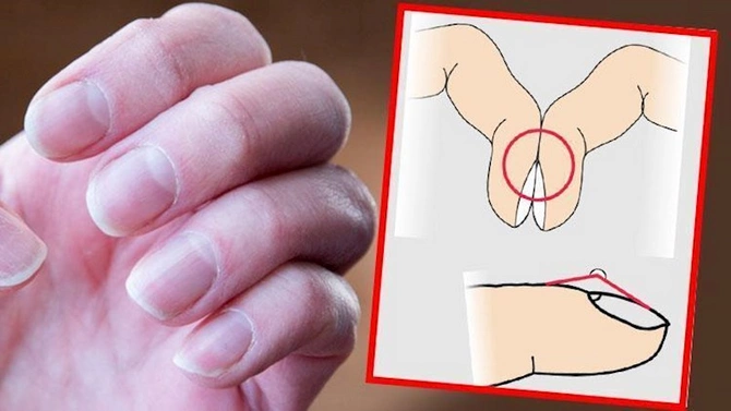 Ölümcül xəstəliyin gizli əlaməti — Barmaqlardakı bu dəyişiklik sizi xəbərdar edir (FOTO) Ölümcül xəstəliyin gizli əlaməti — Barmaqlardakı bu dəyişiklik sizi xəbərdar edir (FOTO)