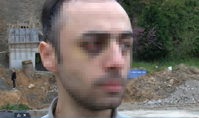 Türkiyədə azərbaycanlı tələbəni döyüb videoya çəkənlərə ağır cəza — FOTOLAR Türkiyədə azərbaycanlı tələbəni döyüb videoya çəkənlərə ağır cəza — FOTOLAR