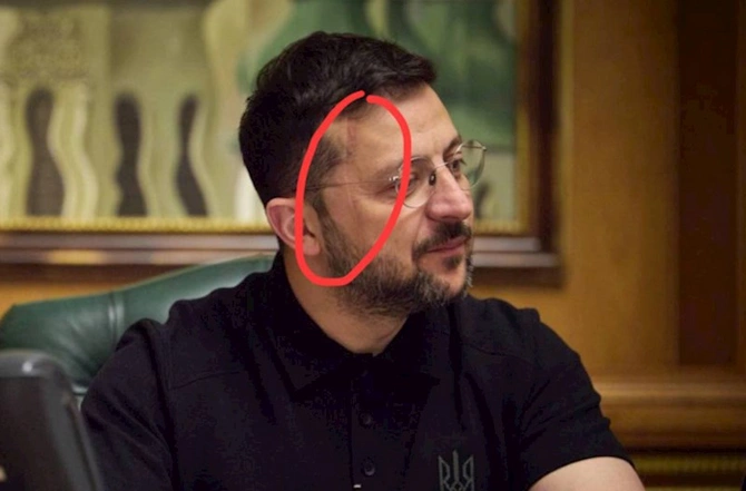 Zelenskinin üzünə nə olub? — FOTO Zelenskinin üzünə nə olub? — FOTO