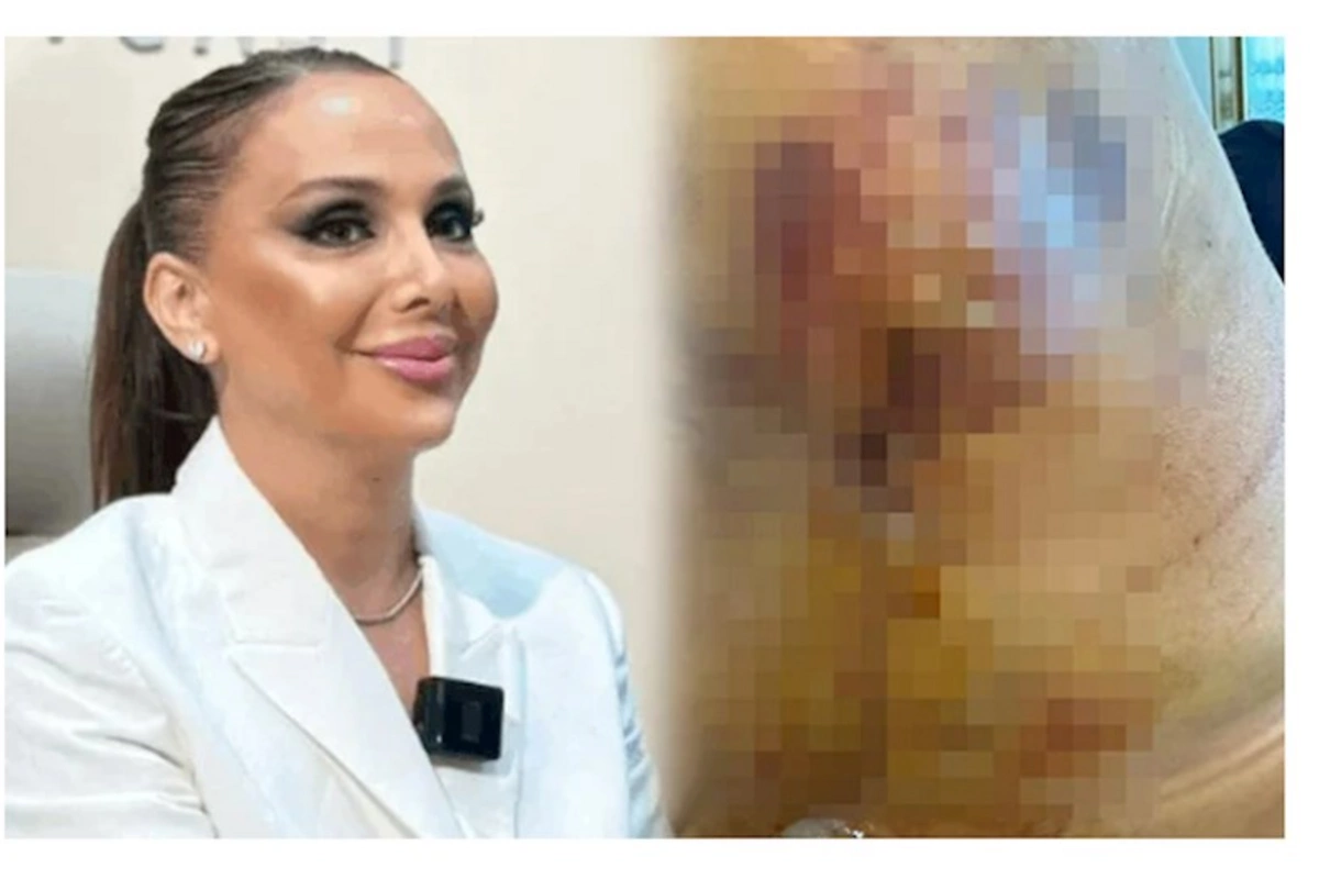 “Həkim məni 3 dəfə əməliyyat edib pis vəziyyətə qoydu” — FOTOLAR