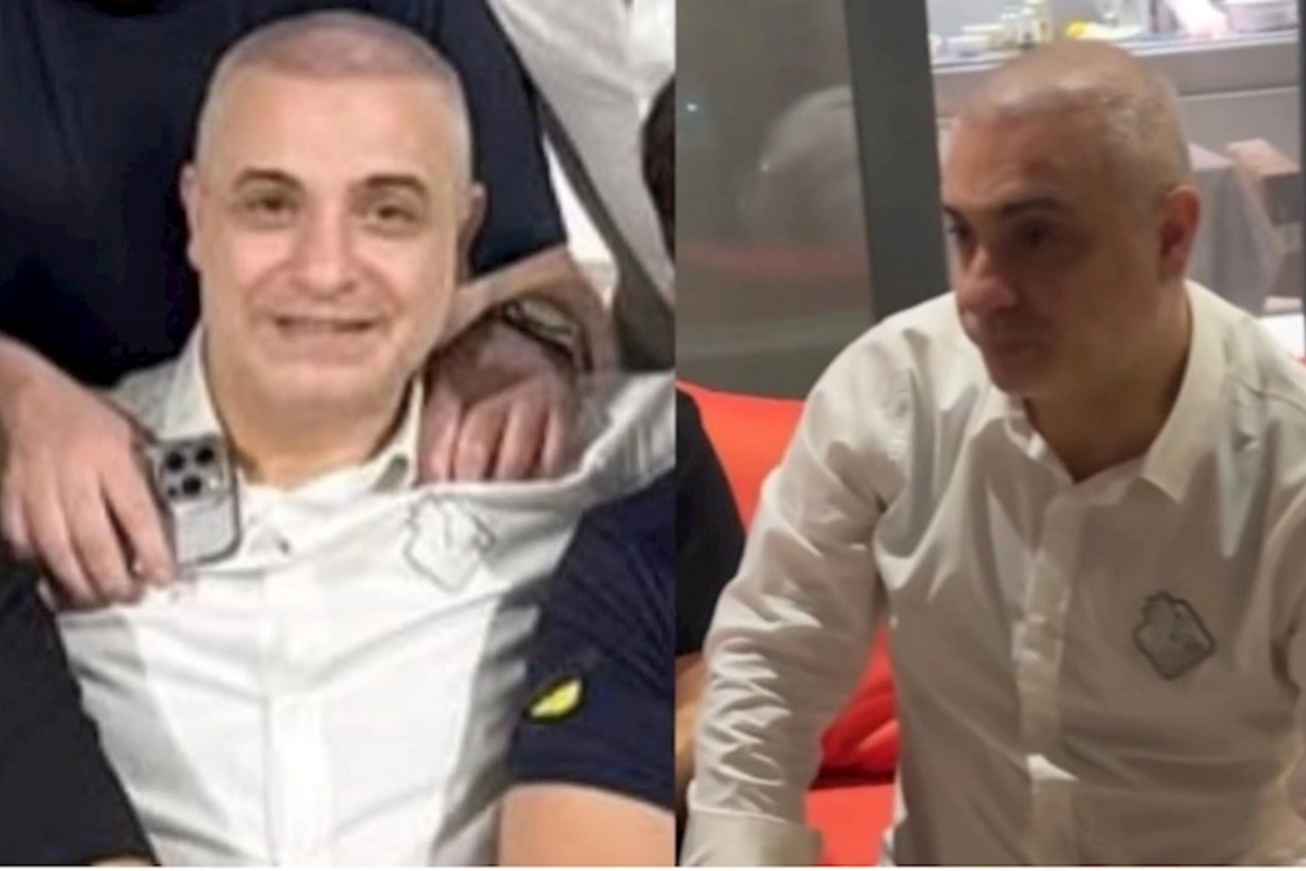 Rüfət Axundov saç əkdirib