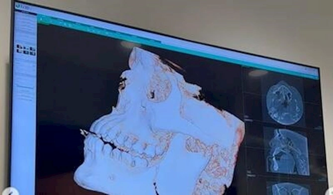 Azərbaycanlı idmançı onun çənəsini sındırdı — VİDEO ( FOTO) Azərbaycanlı idmançı onun çənəsini sındırdı — VİDEO ( FOTO)