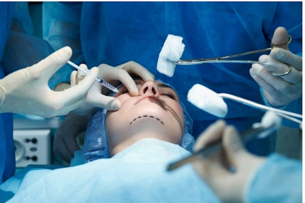 Plastik cərrahlarla bağlı 12 şikayət DAXİL OLUB — RƏSMİ