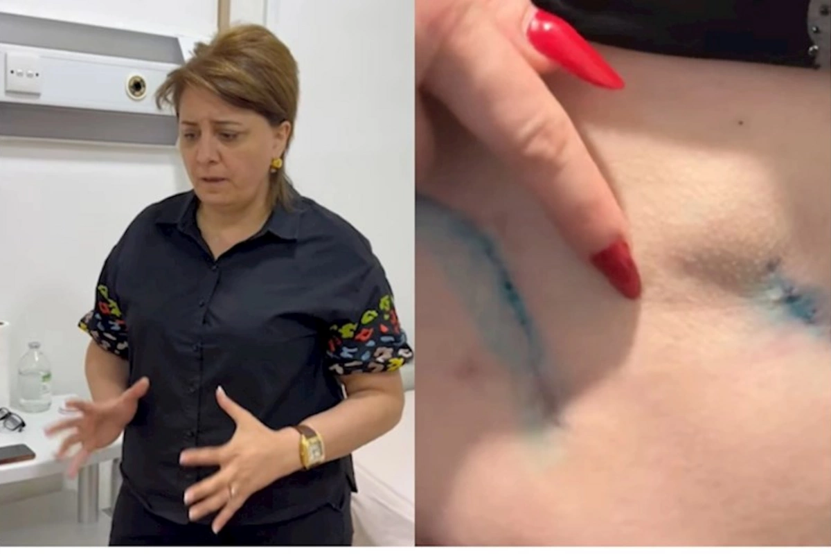 Prokurorluqda pasiyentin ölüm işində adı keçən həkim yenidən cərrahlıq edir? — VİDEO