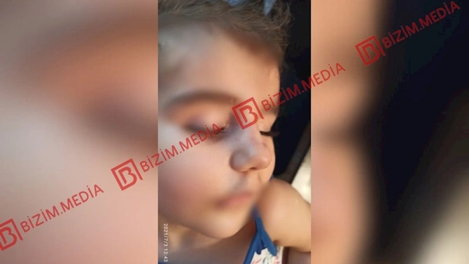 Lənkəranda qandonduran HADİSƏ — Ana isti qaşıqla 3 yaşlı qızının qolunu DAĞLADI (FOTOLAR)
