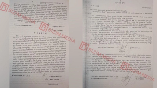 Lənkəranda qandonduran HADİSƏ — Ana isti qaşıqla 3 yaşlı qızının qolunu DAĞLADI (FOTOLAR)