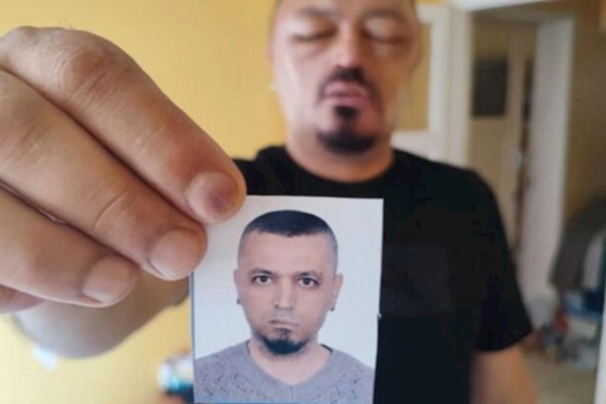 İnternetdən aldığı şampun həyatını kabusa çevirdi — FOTO