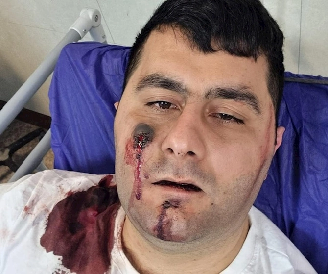 İranda səfirliyimizə hücum edən terrorçunu ram edən qəhrəmanın anasının sensasion müsahibəsi — FOTOLAR