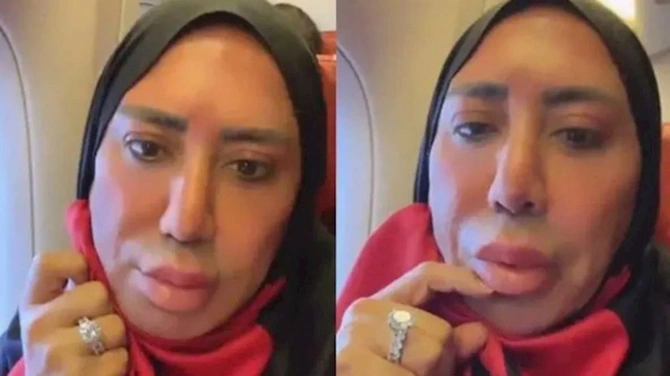 Qadın paltarında saxlanılan fenomen həbsdən tanınmaz halda çıxdı — FOTOLAR Qadın paltarında saxlanılan fenomen həbsdən tanınmaz halda çıxdı — FOTOLAR