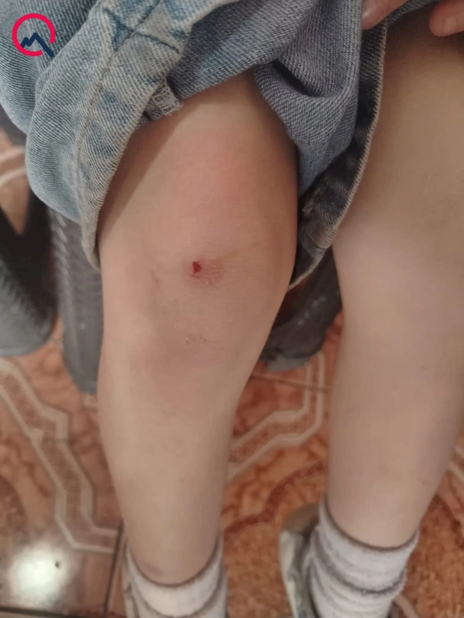 “4-cü sinif şagirdi nəvəmi məktəbin sanitar qovşağında döyüb” — FOTOLAR “4-cü sinif şagirdi nəvəmi məktəbin sanitar qovşağında döyüb” — FOTOLAR
