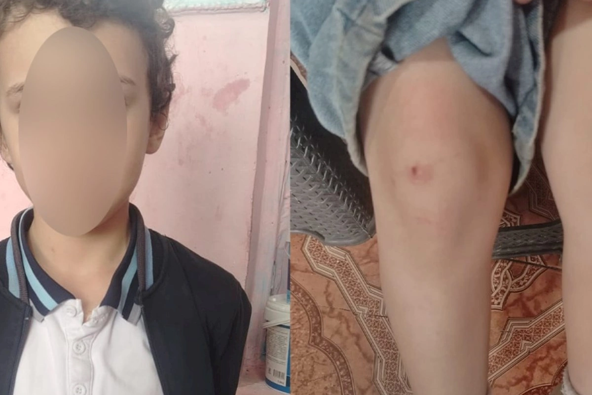 “4-cü sinif şagirdi nəvəmi məktəbin sanitar qovşağında döyüb” — FOTOLAR