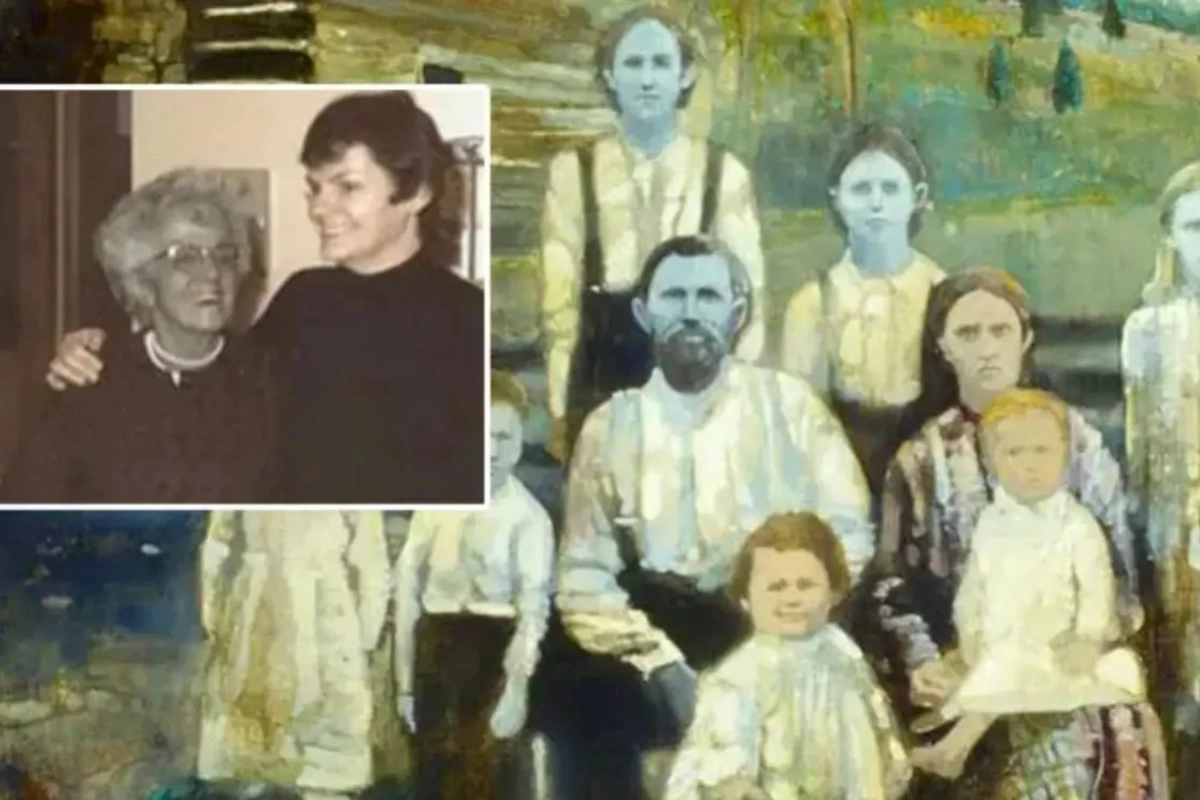 Qohum evliliyinə görə uşaqları mavi dərili doğuldu — FOTOLAR