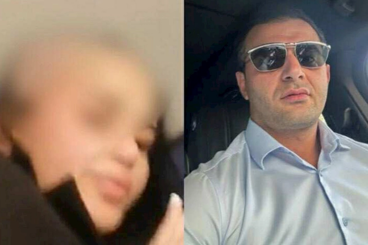 Arvadının saçını keçəl edən ərə hökm oxundu
