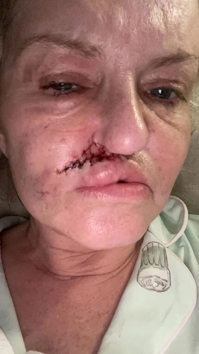 Bir zamanlar ölkəsinin ən məşhurlarından idi, indi tanınmaz haldadır — FOTOLAR Bir zamanlar ölkəsinin ən məşhurlarından idi, indi tanınmaz haldadır — FOTOLAR