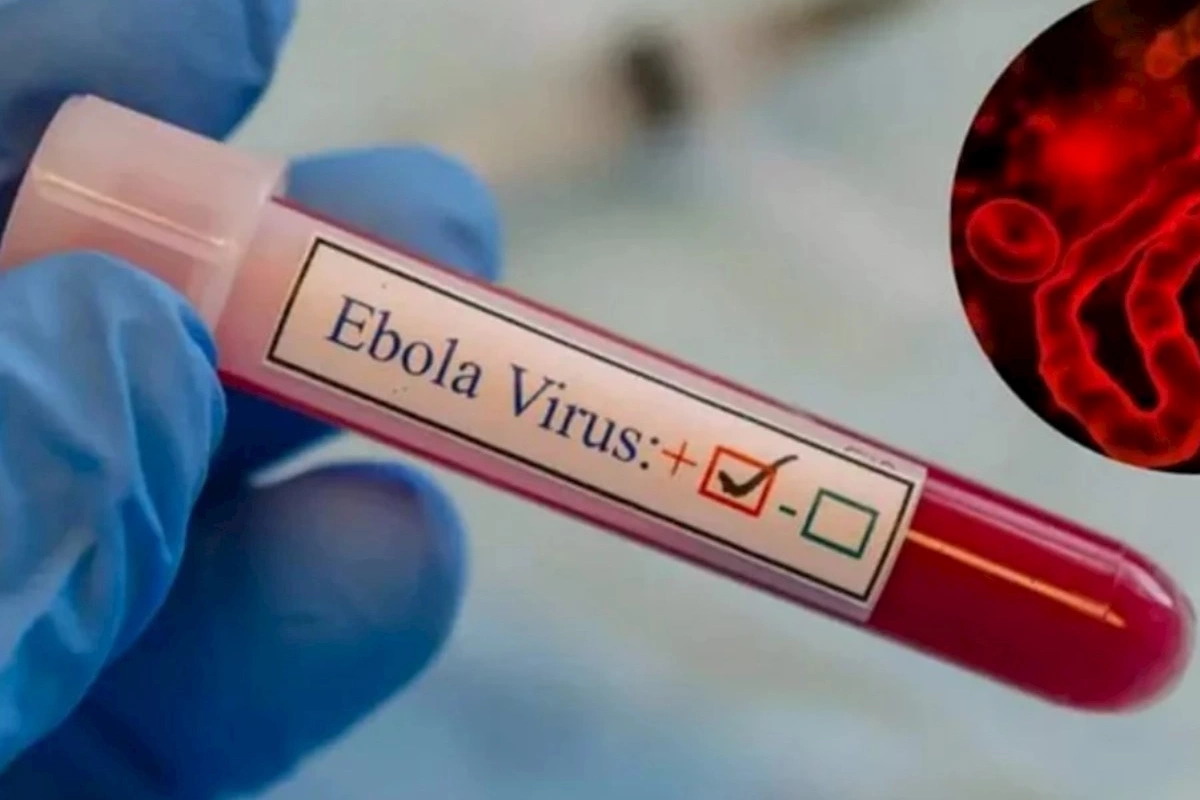 Ebola yenidən can alır: Yeni ştamma qarşı hələ ki, dərman yoxdur!