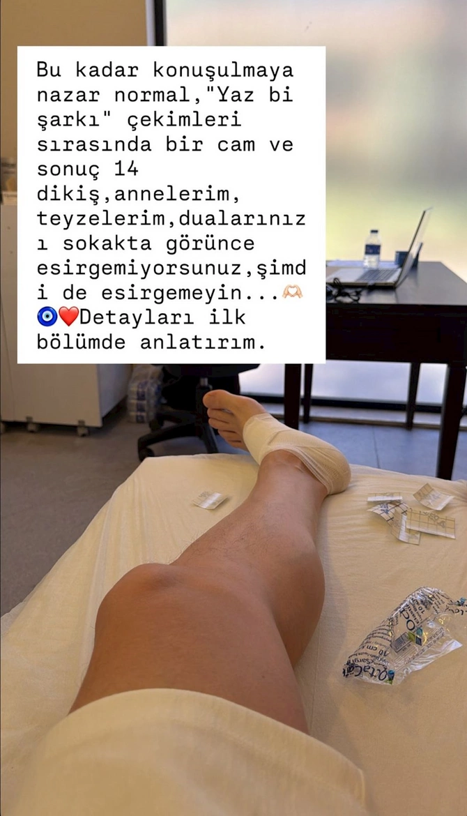 Çəkiliş meydançasında qəza: Xəstəxanaya yerləşdirildi — FOTO Çəkiliş meydançasında qəza: Xəstəxanaya yerləşdirildi — FOTO