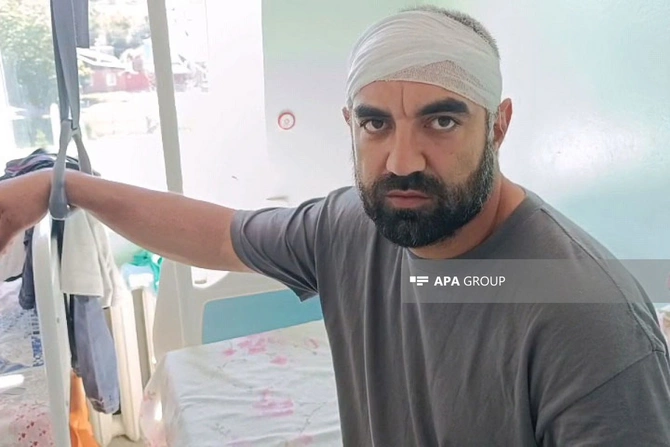 PUA hücumu nəticəsində yaralanan Azərbaycan vətəndaşlarının son durumu — FOTOLAR