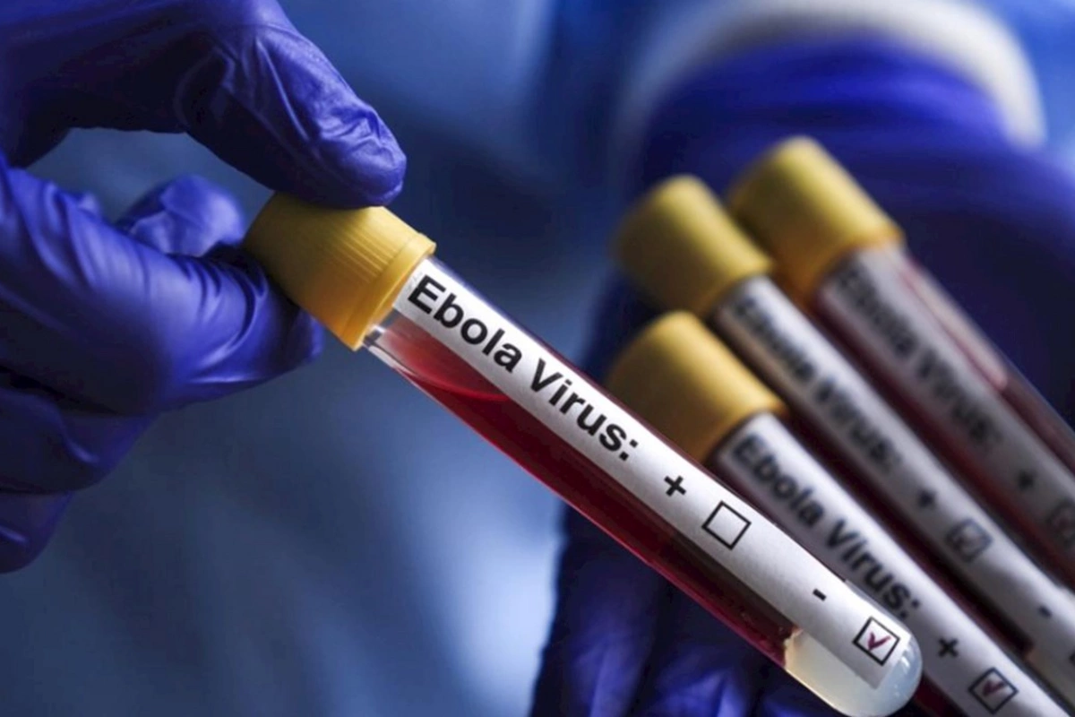 ABŞ-dən Ebola ilə bağlı xəbərdarlıq