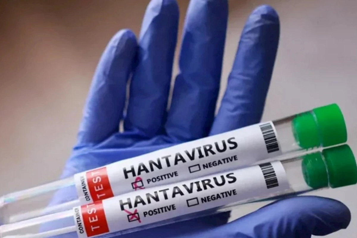 Venesuelada hantavirus diaqnozu təsdiqlənmiş üç pasiyent ölüb