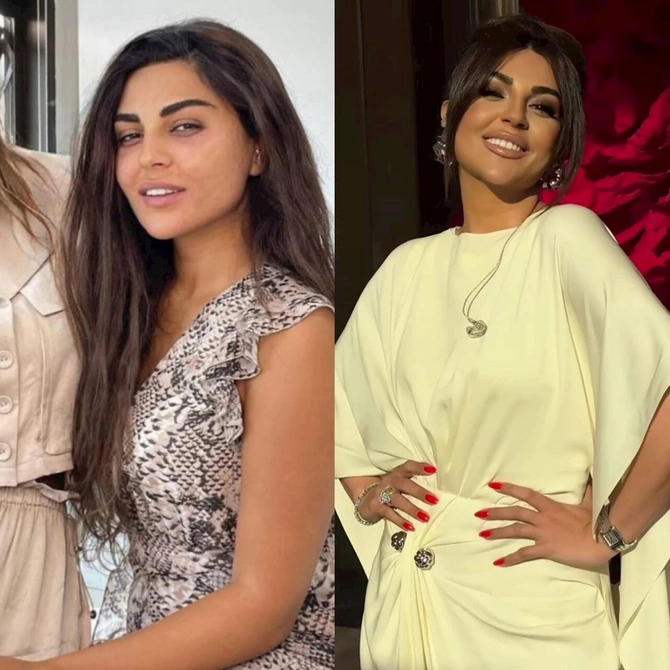 Azərbaycanlı məşhurların makiyajsız görüntüləri gündəm oldu — FOTOLAR