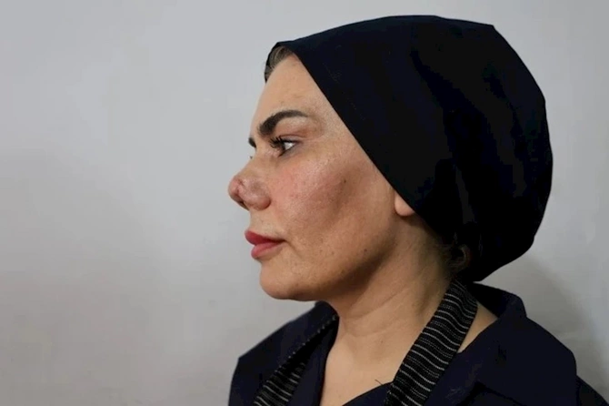 Burnunu düzəltdirmək istədi, 4 əməliyyatdan sonra məhkəməyə üz tutdu — FOTOLAR