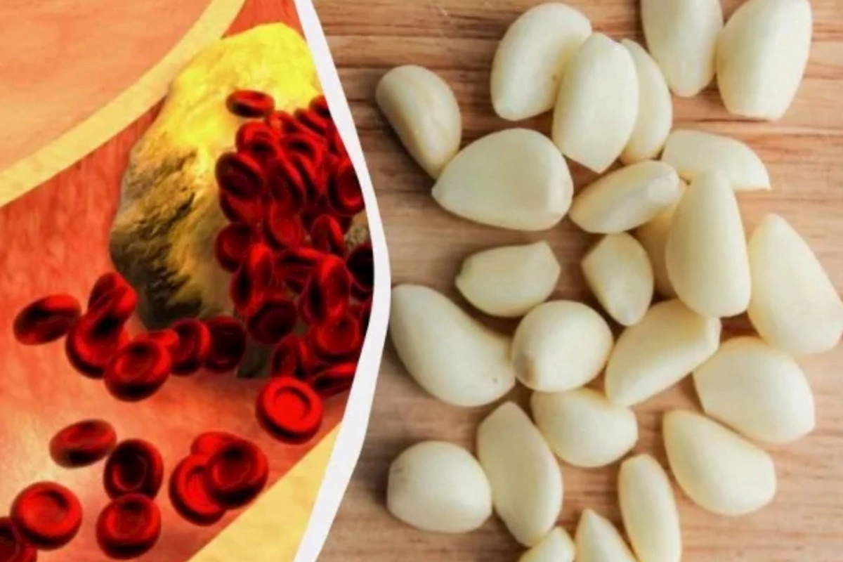 Xolesterini salmaq üçün bu qidanı çiy yeyin — Alimlər 5 təsirini açıqladı
