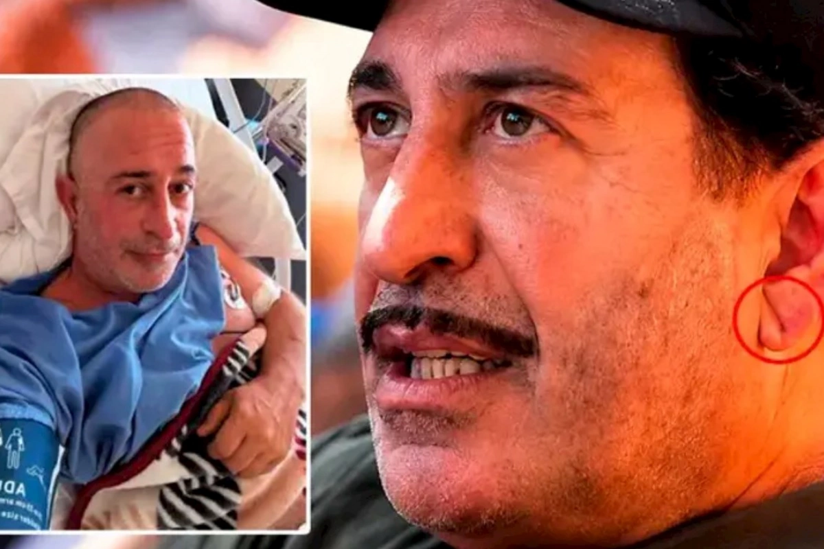 Cem Yılmazın qulağındakı xətt diqqət çəkdi: Frank əlaməti infarktın xəbərçisidir?