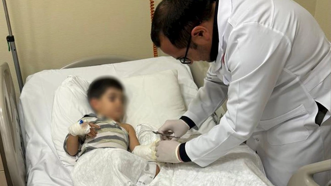 Həkimlər 3 yaşlı uşağın əlini xilas etdi — FOTOLAR
