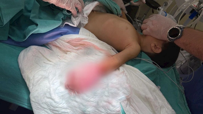 Həkimlər 3 yaşlı uşağın əlini xilas etdi — FOTOLAR