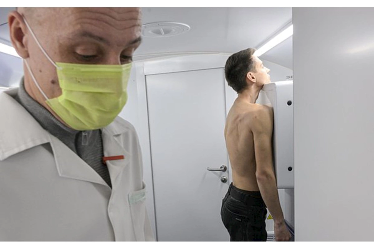 Rusiyada antibiotiklərə davamlı vərəm ştammı aşkar edildi